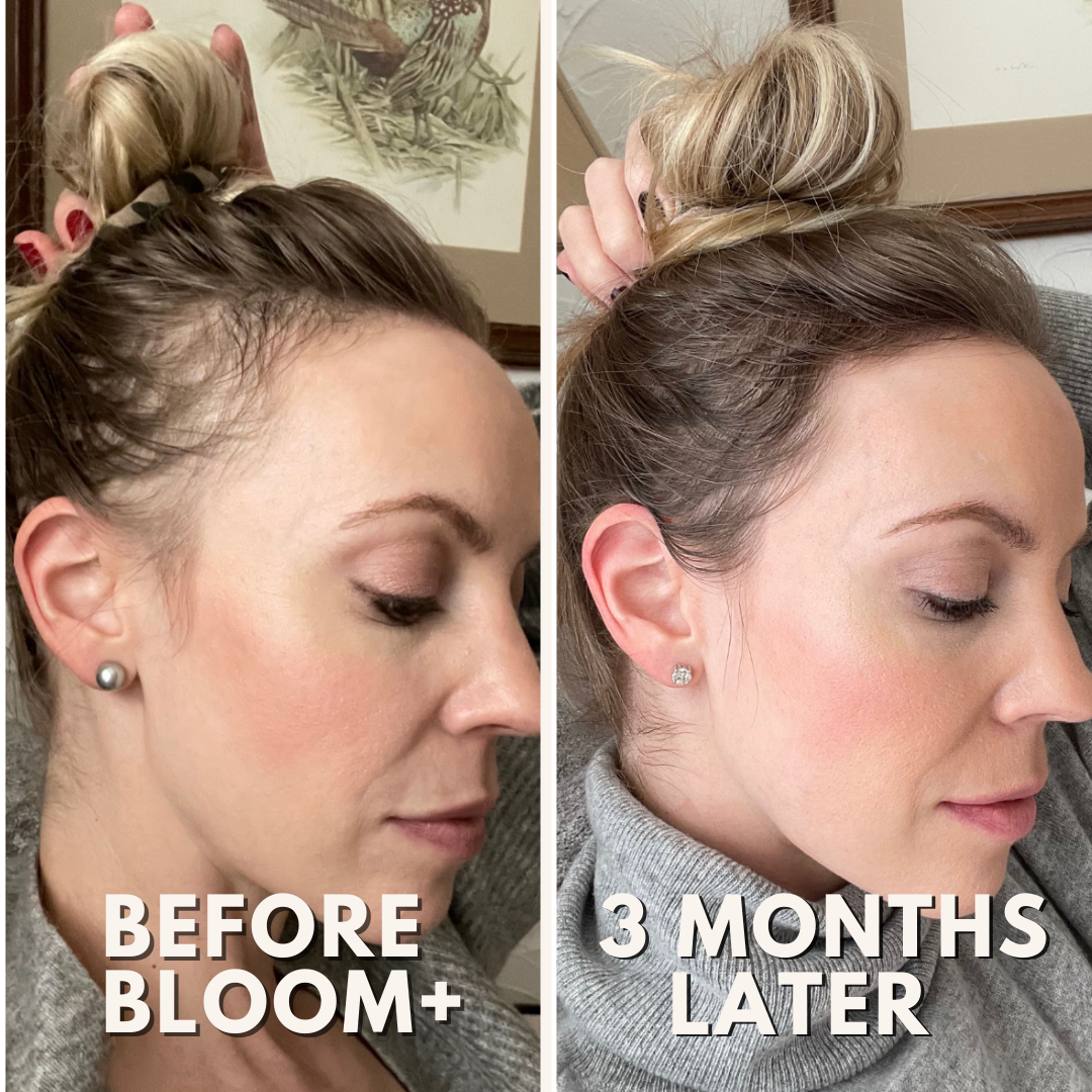 BLOOM+ Hair Growth Revival Serum