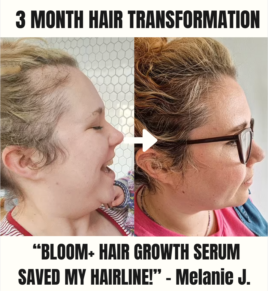 BLOOM+ Hair Growth Revival Serum