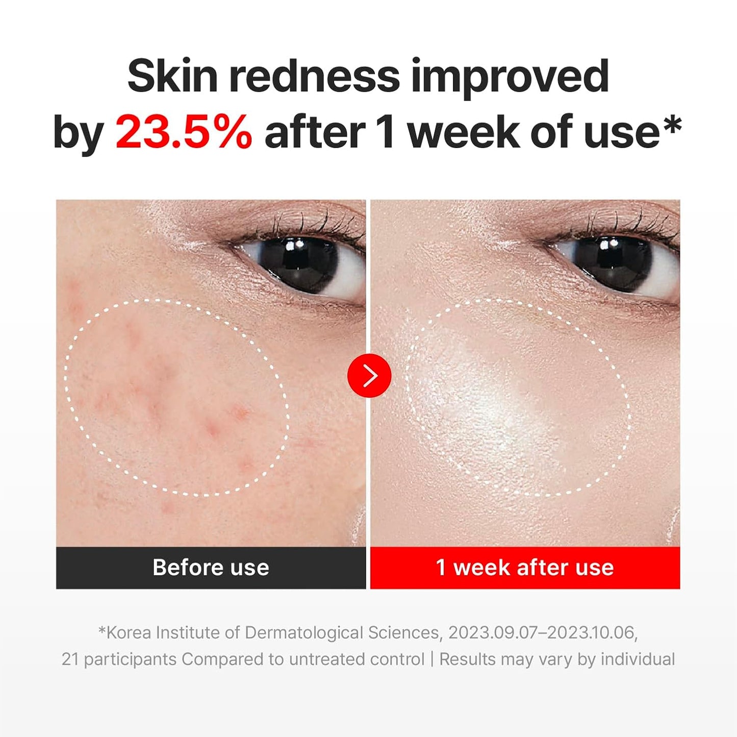 Madeca Cream Time Reverse - Anti-Aging Cica Moisturizer with Hyaluronic Acid